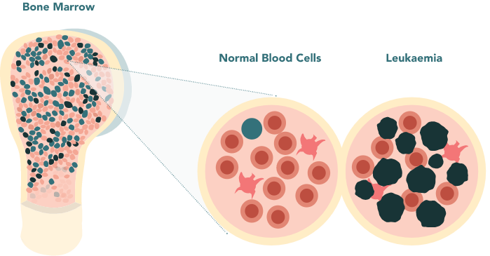 about-diagram